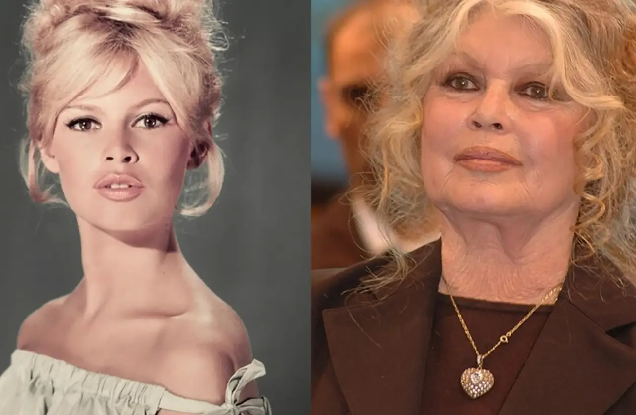 2022 01 brigitte bardot son evolution physique en images jpeg.jpg