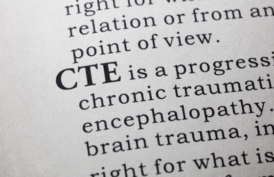 A Conceptual Brain Science of CTE — Chronic Traumatic Encephalopathy shutterstock 406978171