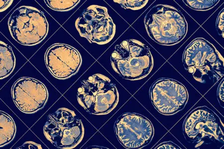 Brain Science Lingered at Neurons. NIH Defunded Them Brain Science Lingered at Neurons. NIH Defunded Them