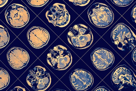 Brain Science Lingered at Neurons. NIH Defunded Them shutterstock 685870705