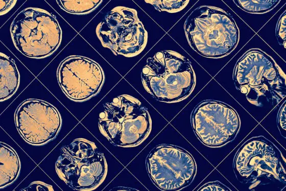 Brain Science Lingered at Neurons. NIH Defunded Them