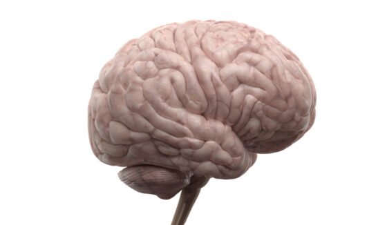 LLMs: Gary Marcus Loss Function in AI Delusion, Sentience, Human Intelligence, Consciousness, Psychosis